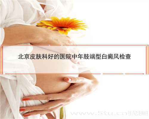 北京皮肤科好的医院中年肢端型白癜风检查